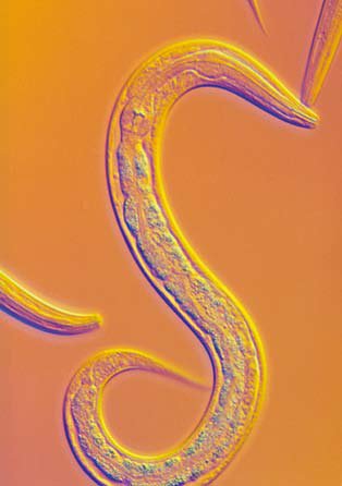 环球科学:激光控制大脑已经成为现实